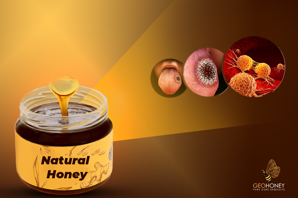 A New Research Found - Organic Honey Is A Natural Treatment For Oral Cancer Wounds